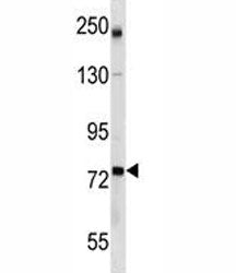 GCLC Antibody