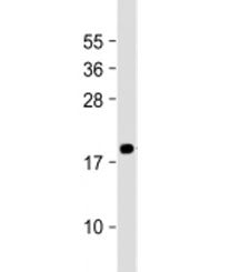 Western blot testing of human PC-3 cell lysate with MEAF6 antibody at 1:2000. Predicted molecular we