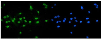 FXR Antibody / Farnesoid X Receptor / Bile Acid Receptor NR1H4 (C-Terminal Region)