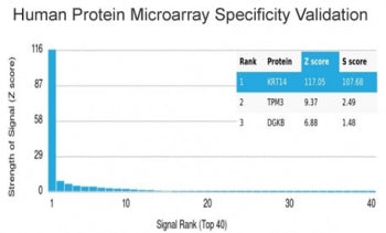 Cytokeratin 14 Antibody / CK14 / KRT14