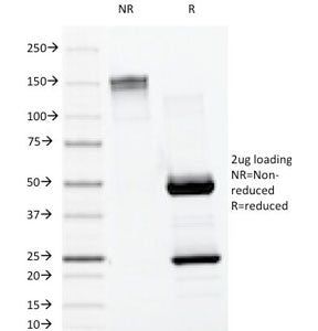 Lambda Light Chain Antibody / Lambda Antibody