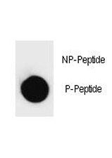 Phospho-PARP1 Antibody (pT368)