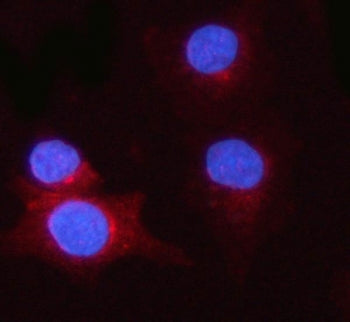 PSME1 Antibody / Proteasome activator complex subunit 1