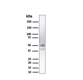 Western blot testing of human liver lysate with PSMD4 antibody. Predicted molecular weight ~41 kDa, 