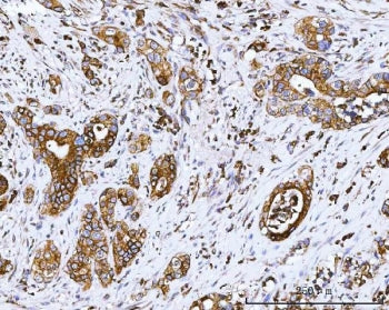 COX2 Antibody