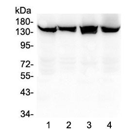 Western blot testing of human 1) HeLa, 2) A549, 3) MCF7 and 4) MDA-MB-453 lysate with SMC3 antibody 