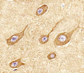 SCG10 Antibody / STMN2