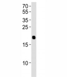 HRAS Antibody