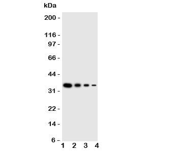 LAT2 Antibody
