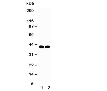 TBP Antibody TATA Binding Protein