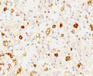 IHC: Formalin-fixed, paraffin-embedded human pituitary stained with FSH-beta antibody (clone FSHb/10