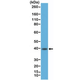 CD23 Antibody