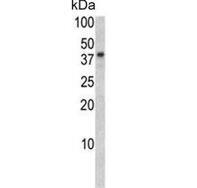 BGN Antibody / Biglycan