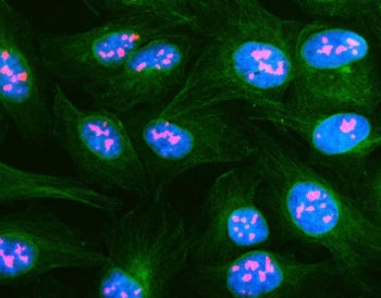 NSUN1 Antibody / NOP2 / Nucleolar protein 2