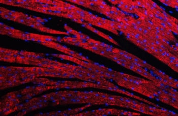 Immunofluorescent staining of FFPE mouse heart tissue with Desmin antibody (red) and DAPI nuclear st