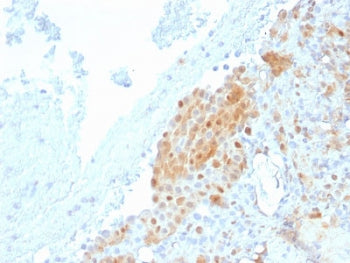 Calbindin 2 Antibody / CALB2 / Calretinin