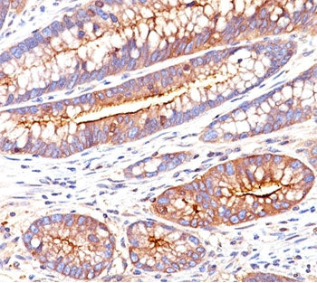 CEA Antibody / Carcinoembryonic Antigen