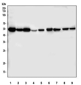 Western blot testing of 1) human SH-SY5Y, 2) human HeLa, 3) human K562, 4) human A549, 5) human HepG