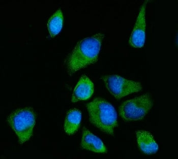 RPS2 Antibody / 40S ribosomal protein S2