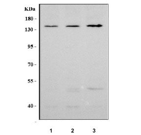 Western blot testing of human 1) HeLa, 2) A549 and 3) PC-3 cell lysate with Neuropilin 1 antibody. E