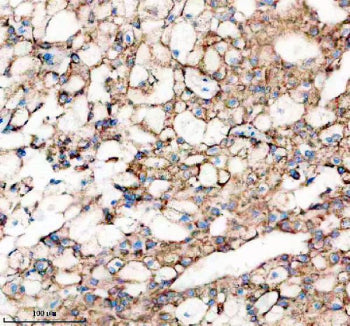 SHH Antibody / Sonic Hedgehog, 100ul