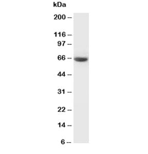 Western blot testing of GAD65 antibody and rat brain tissue lysate. Predicted molecular weight ~65 k
