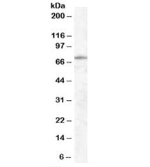 Western blot testing of human lung lysate with EXOC7 antibody at 0.5ug/ml. Predicted molecular weigh