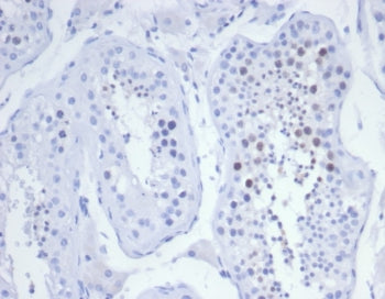 IHC staining of FFPE human testis tissue with KIF2C antibody (clone KIF2C/6525) at 2ug/ml. HIER: boi
