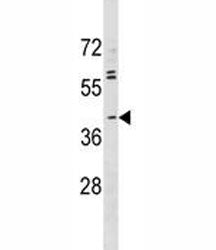 ABO Antibody