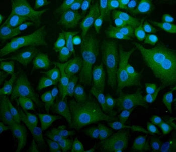 Immunofluorescent staining of FFPE human A549 cells with STIM1 antibody (green) and DAPI nuclear sta