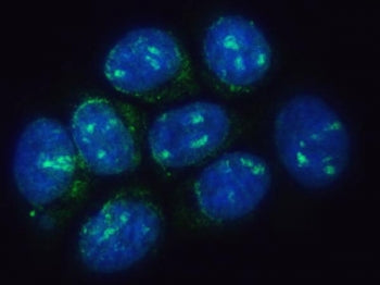 Immunofluorescent staining of FFPE human MCF7 cells with TMEM50B antibody (green) and DAPI nuclear s