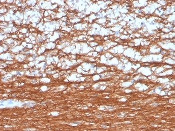 IHC staining of FFPE human cerebellum with recombinant PGP9.5 antibody (clone rUCHL1/4557). HIER: bo