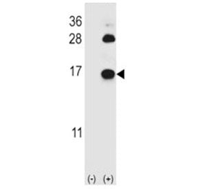 FABP4 Antibody