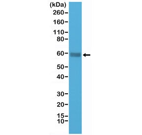 CD5 Antibody