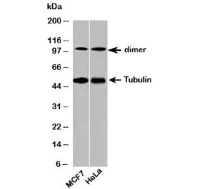 Beta Tubulin Antibody Loading Control