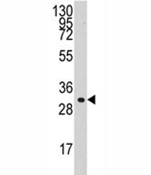 Cyclin C Antibody (CCNC)