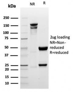 SDS-PAGE analysis of purified, BSA-free recombinant Myogenin antibody (clone MYOG/6298R) as confirma