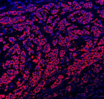 Paxillin Antibody