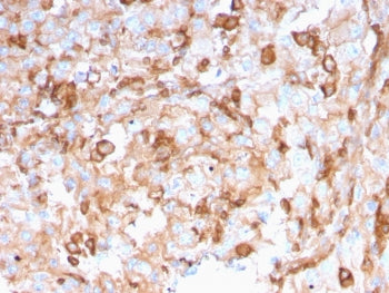 SERBP1 Antibody / PAI-RBP1