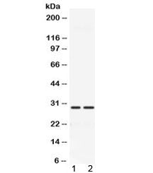 Western blot testing of 1) rat muscle and 2) mouse muscle with CA3 antibody at 0.5ug/ml. Predicted/o