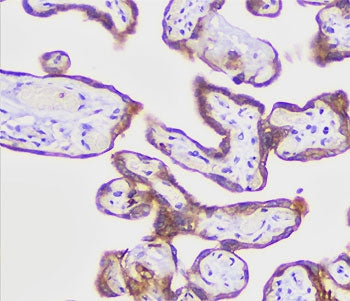 Placental Alkaline Phosphatase Antibody / ALPP