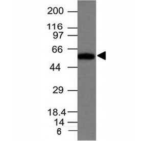 Western blot of HeLa cell lysate using Fascin antibody (clone FSN1/417). Predicted molecular weight: