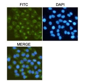 MMP2 Antibody