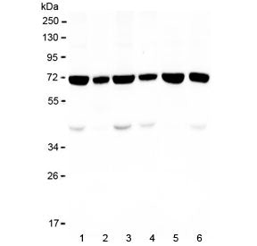 KBTBD2 Antibody