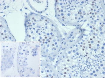 WT1 Antibody / Wilms Tumor 1