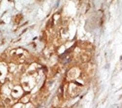 NIK Antibody (NF-kappa-beta-inducing kinase)