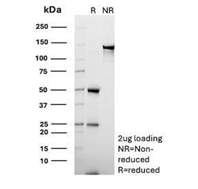 SDS-PAGE analysis of purified, BSA-free CD70 antibody (clone BU69) as confirmation of integrity and 