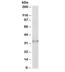 Western blot testing of human colon lysate with Caspase 6 antibody at 0.5ug/ml. Predicted molecular 