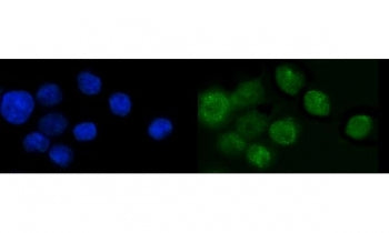 SP6 Antibody / Transcription factor Sp6 / KLF14