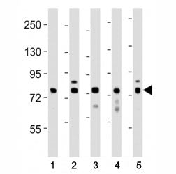 DRP1 Antibody (DNM1L)